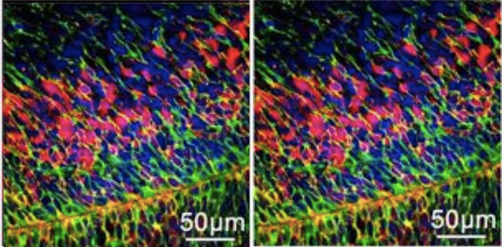 Окрашивание нейральных стволовых и прогениторных клеток в мозге плода, трансфицированных Cre мРНК, доставленной LNP / Автор: UC Regents 
