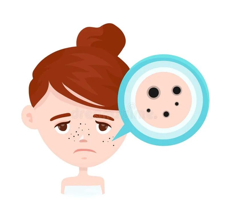 https://thumbs.dreamstime.com/b/acne-black-spots-infographic-acne-black-spots-infographic-vector-modern-flat-style-cartoon-character-illustration-isolated-99463664.jpg
