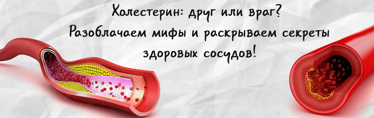 Холестерин: друг или враг? Разоблачаем мифы и раскрываем секреты здоровых сосудов!