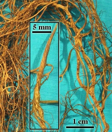 несъедобный лишайник. в чём разница? в жёлтом оттенке и наличии дополнительного компонента симбиоза. 