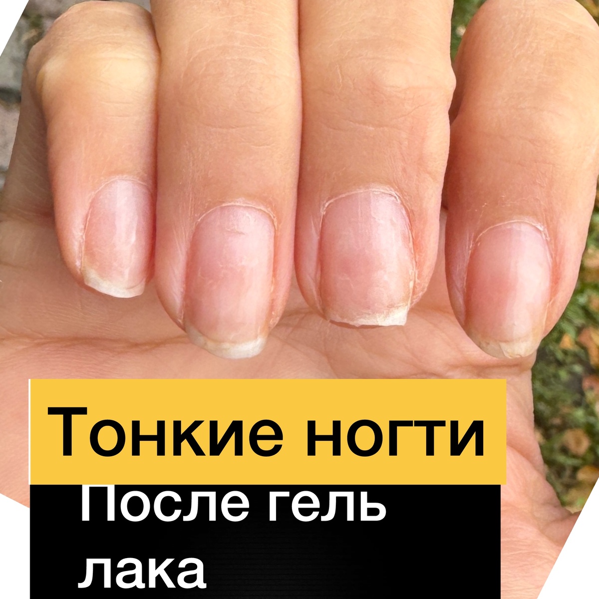 Тонкие ногти после гель лака