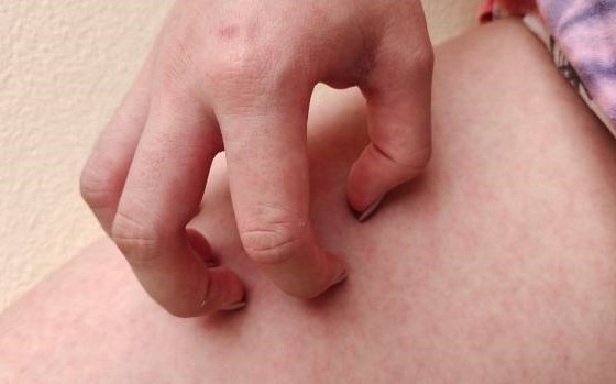 к чему чешется правая ляжка