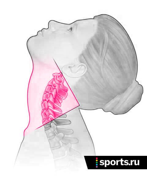 Пример гипермобильности в шейном отделе. Изображение с сайта https://www.sports.ru/