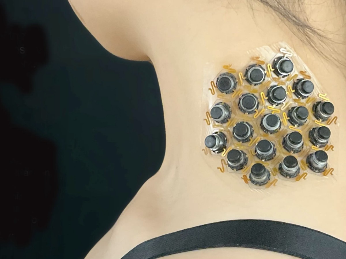    Умный пластырь позволяет удалённо ощущать прикосновения другого человека