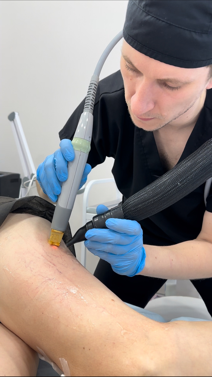 Процесс CLaCS-терапии