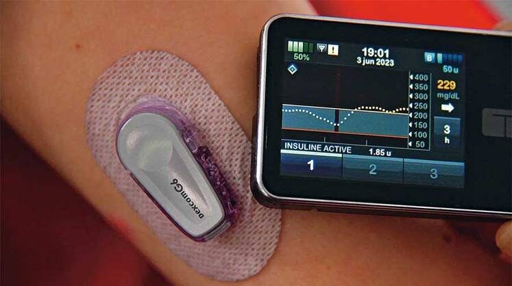    EPA Сахар сегодня признан главным врагом здорового образа жизни. По мнению ученых, нужен непрерывный контроль углеводного обмена не только для больных диабетом, но и для всех желающих