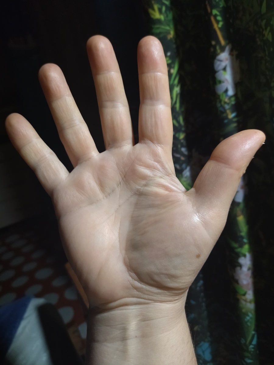 Фото с моего канала. Родинка на ладони.