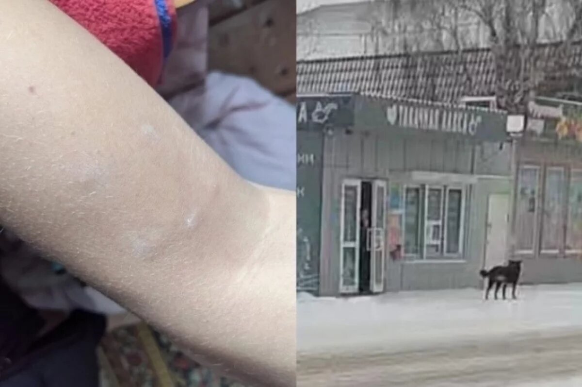    Нападение собаки.