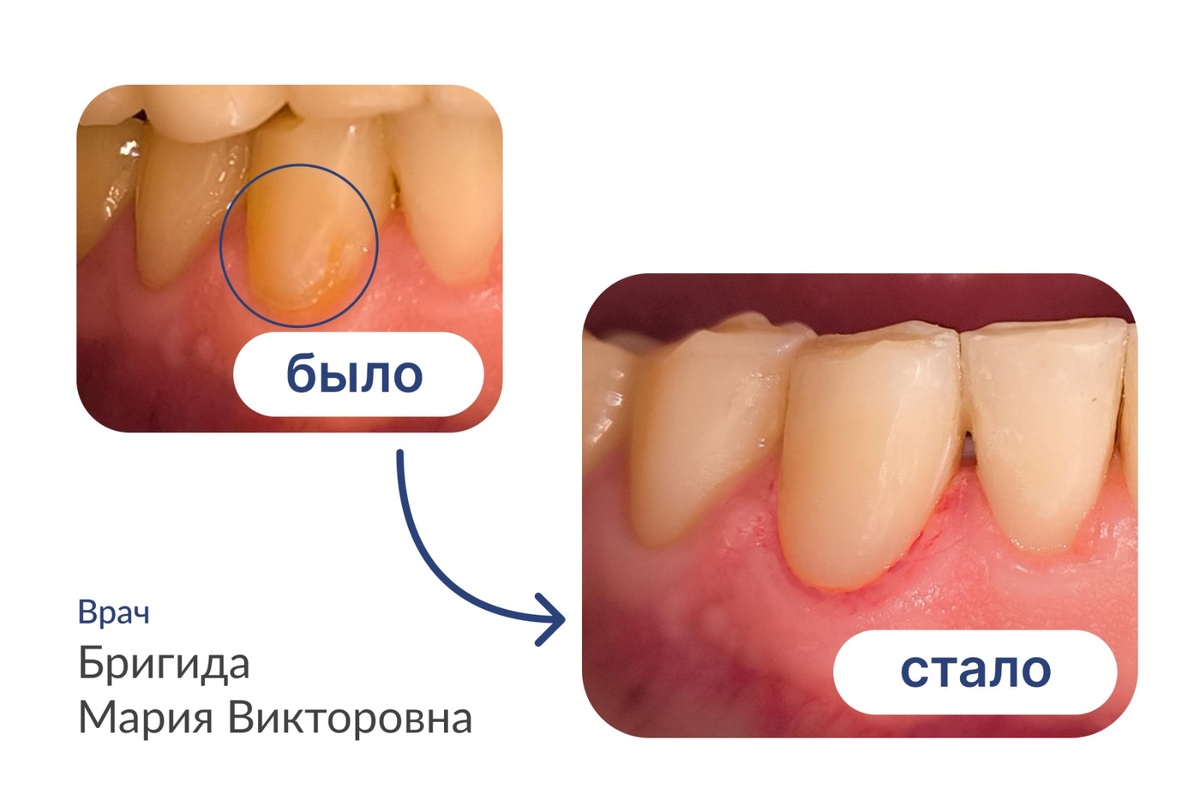 Примерно так это выглядит