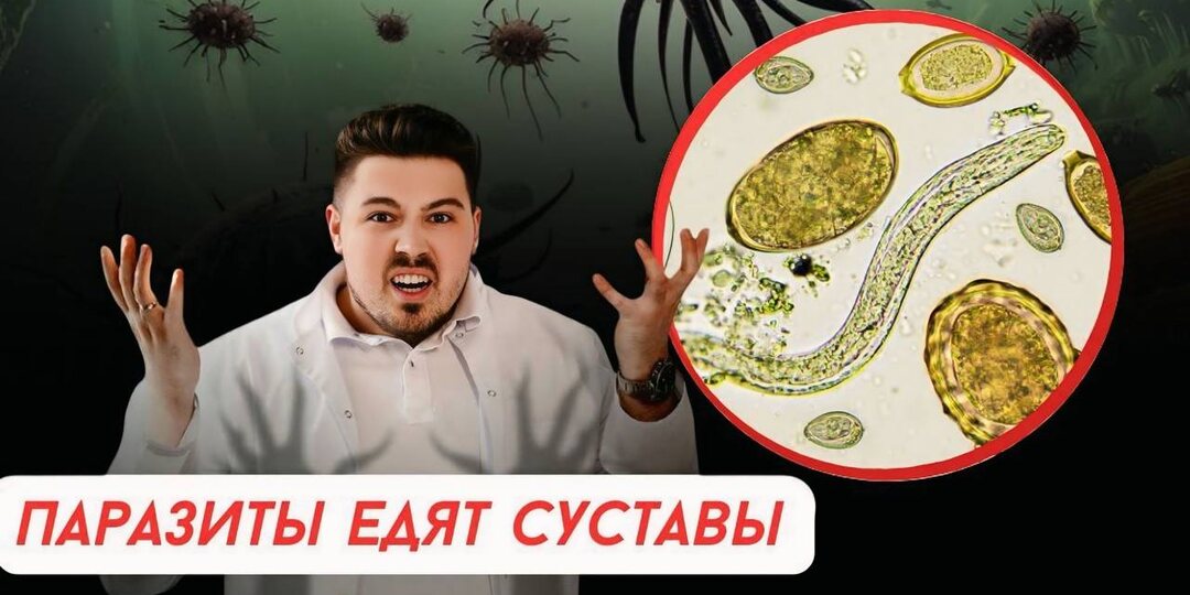 Как паразиты убивают суставы. 5 признаков паразитоза и продукты для устранения проблемы