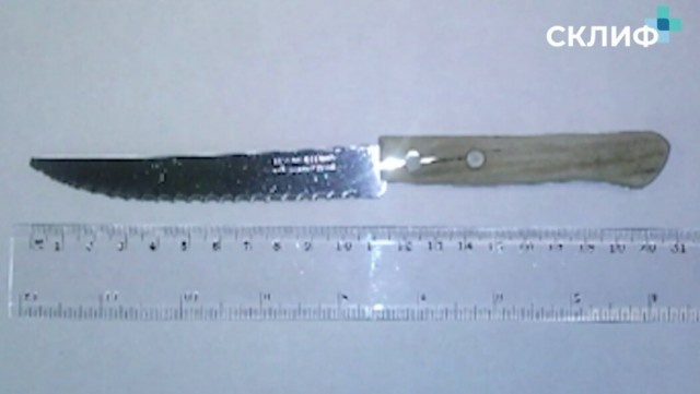 Достали нож из желудка. Проглотил нож во время шашлыка.