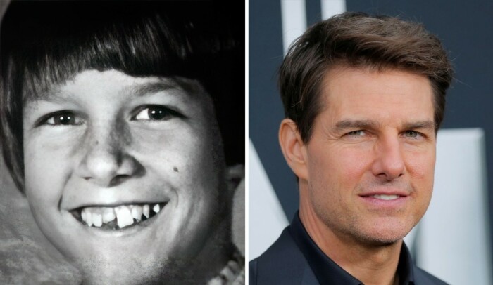  В детстве Том Круз комплексовал из-за кривых зубов.