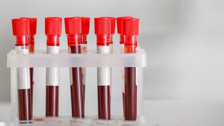 Фото: 123RF/serezniy 