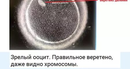 Зрелый ооцит. Правильное веретено