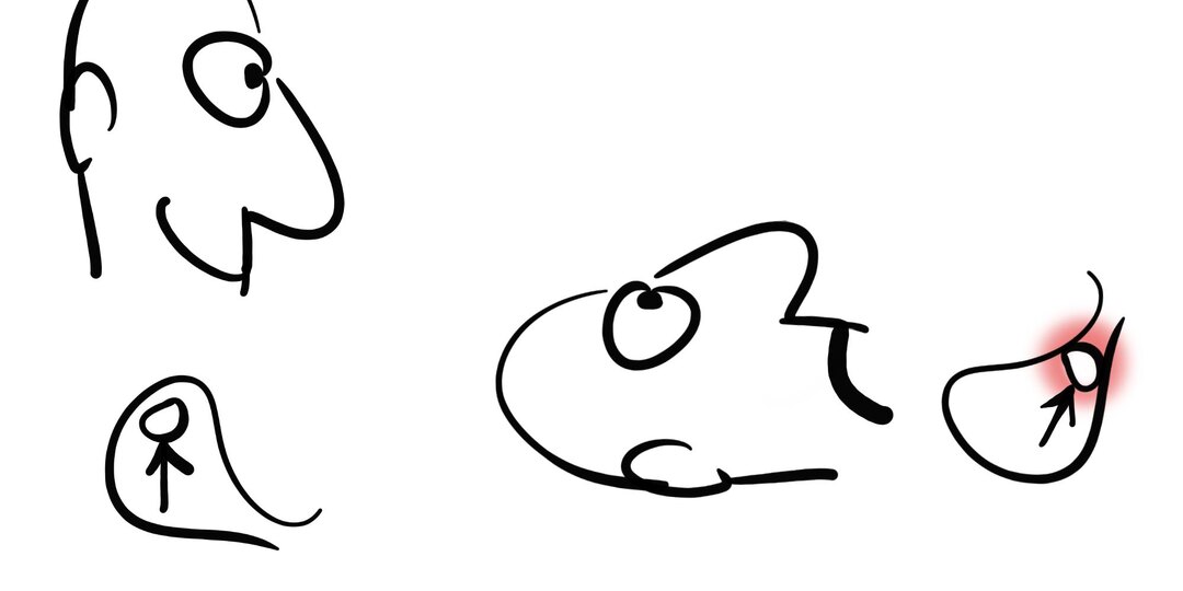 Можно ли делать зарядку при камнях в желчном пузыре?