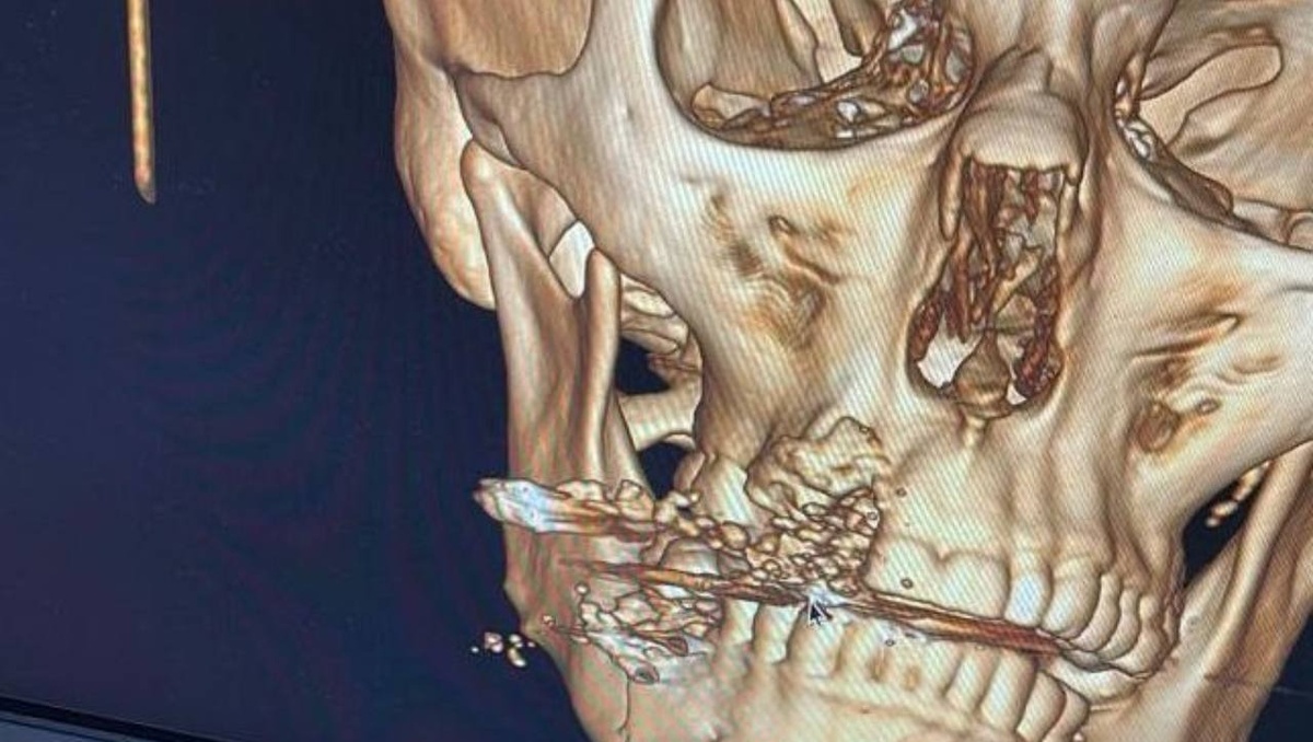     Источник: prosecutor_pk