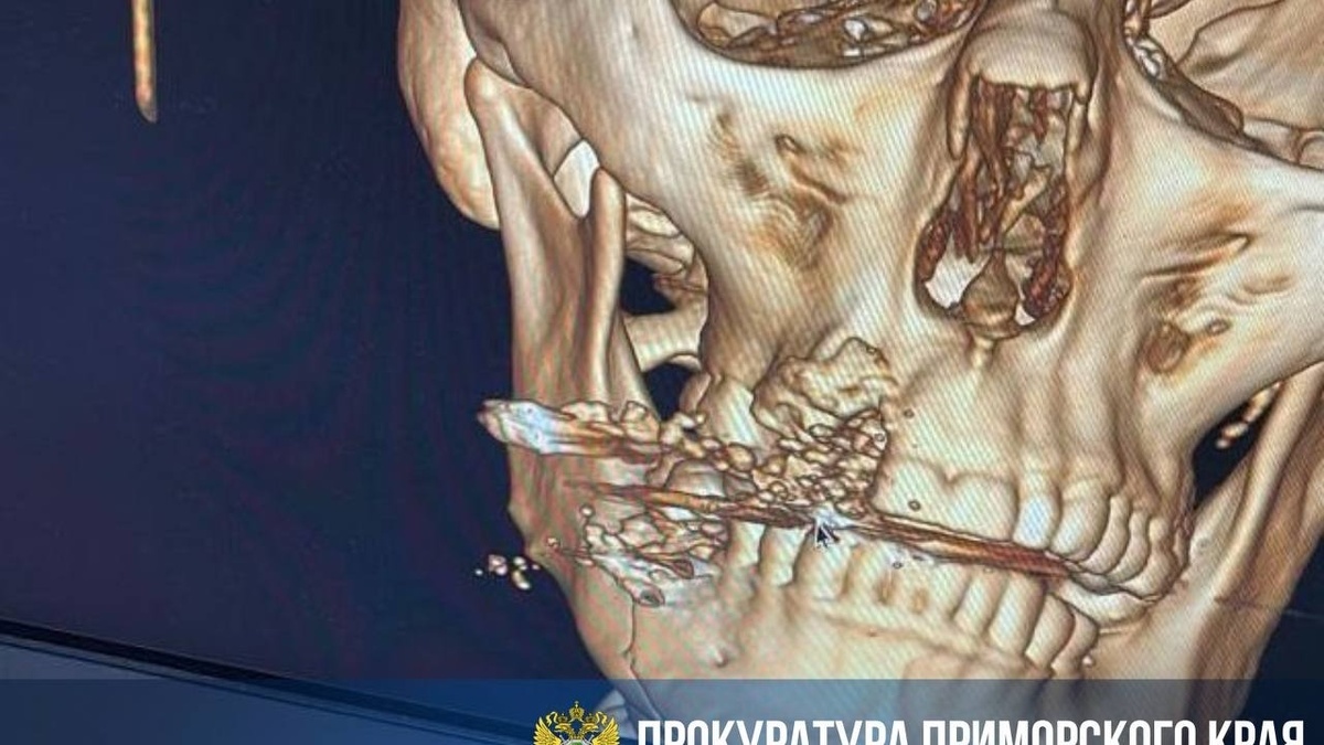     Источник: prosecutor_pk