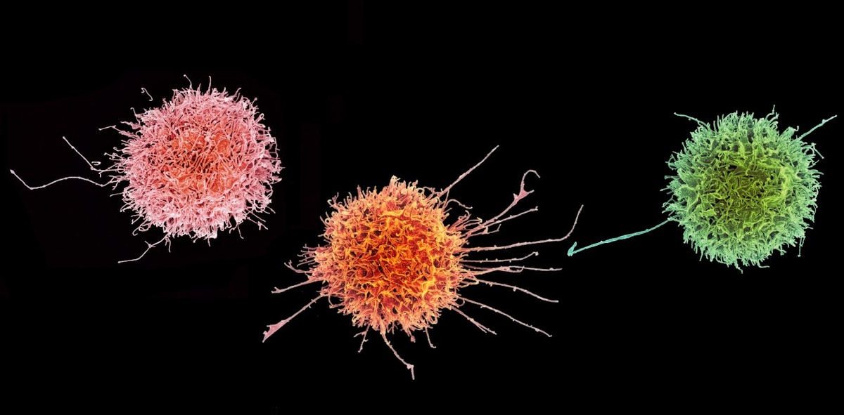 Иммунные клетки – натуральные киллеры (NK-клетки). Сканирующая электронная микроскопия. © CC BY-NC 2.0/NIAID 