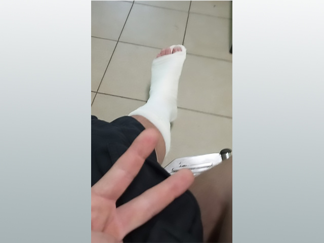 Ребенок повредил ногу, потому что дорожники забросили ремонт в Тверской области