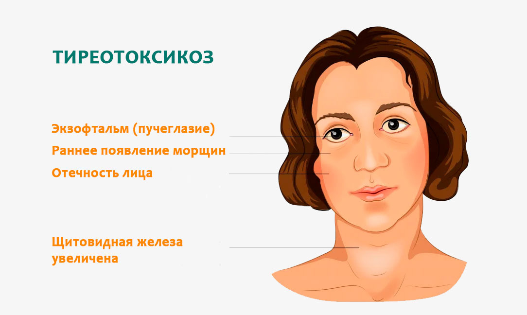 Признаки заболеваний щитовидной железы