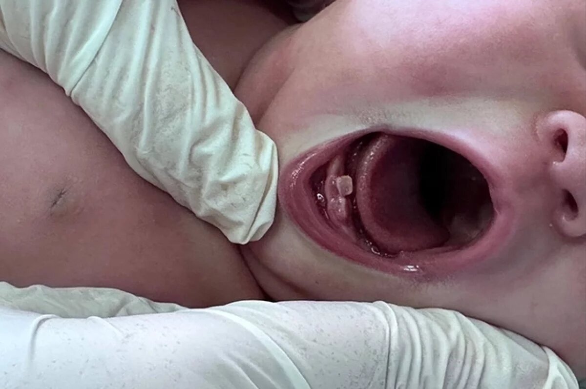    Необычный малыш появился на свет в Королевском роддоме.