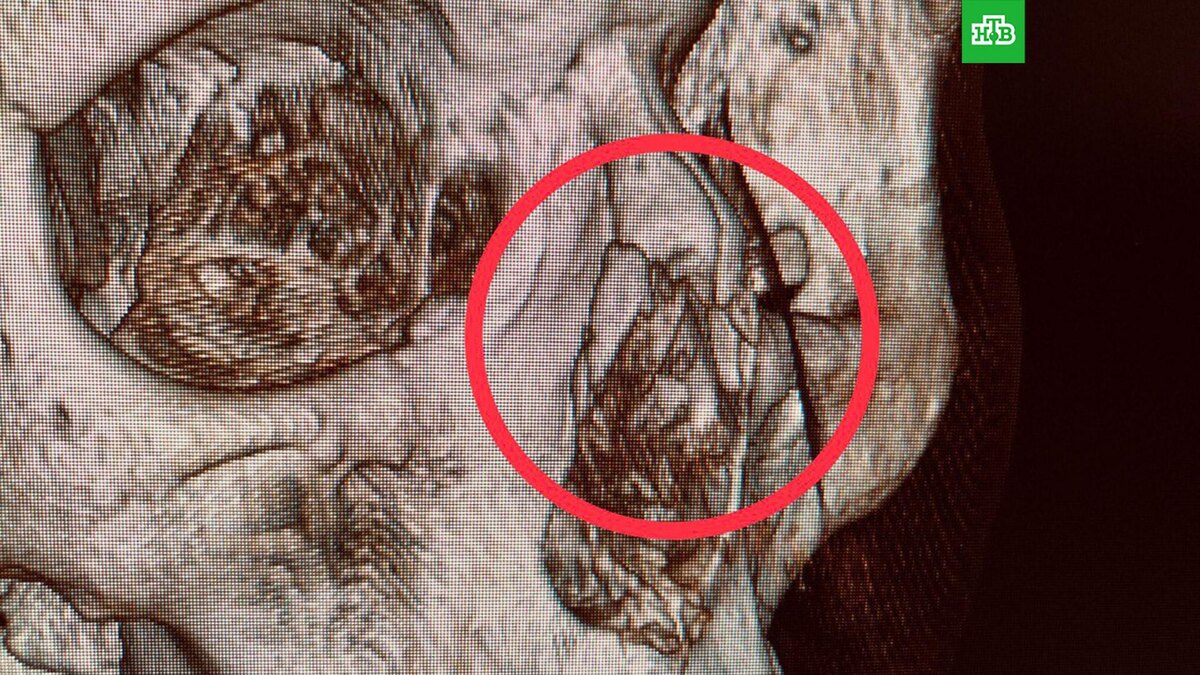    Фото: Министерство здравоохранения Московской области