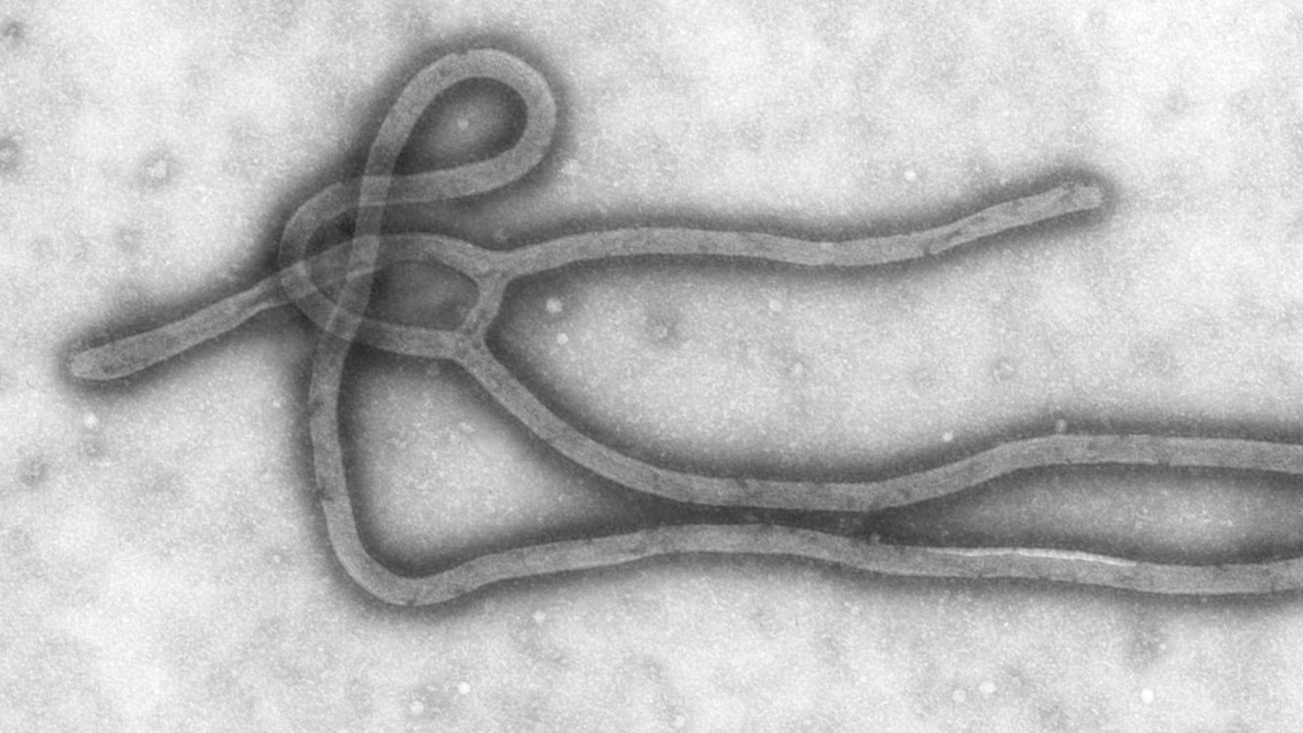    Вирус Эбола под микроскопом