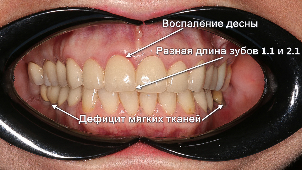 Проблемы, которые беспокоили Анну