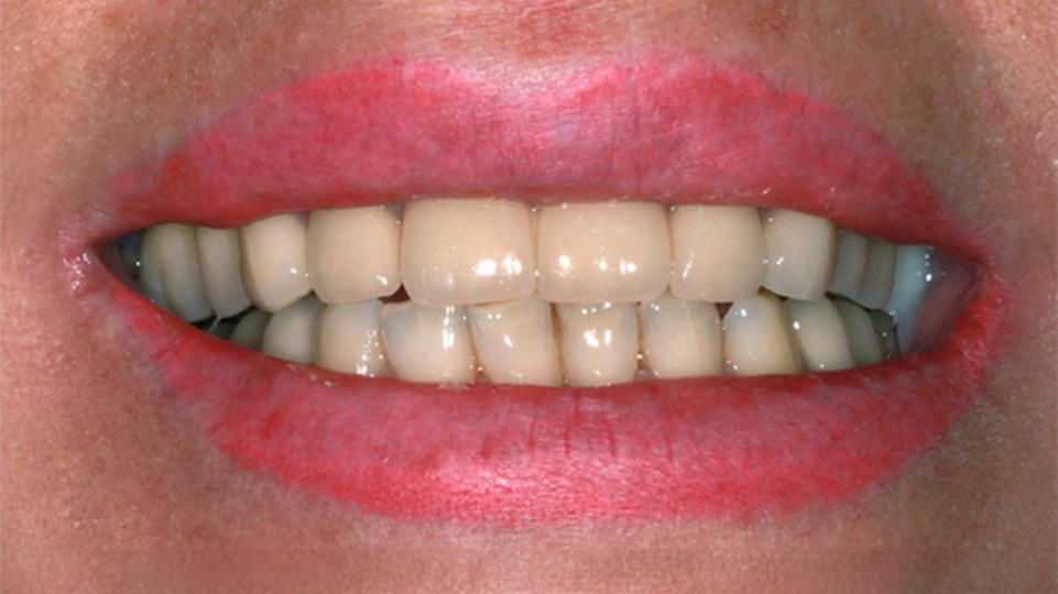 ДО и ПОСЛЕ Анны
