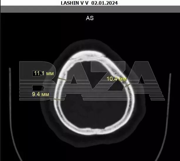     Автор: t.me/bazabazon
