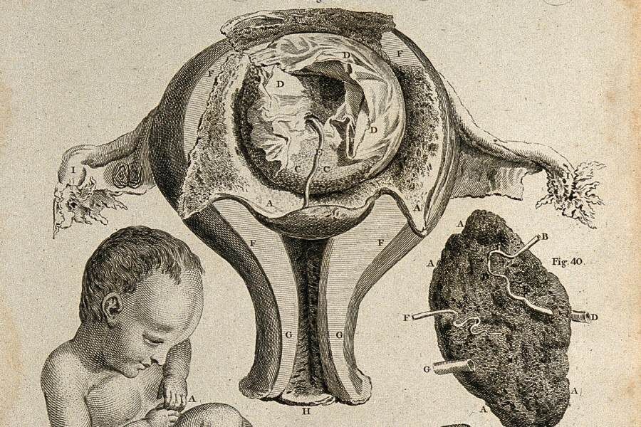  Плод, матка и плацента: три фигуры, демонстрирующие питание плода внутриутробно. Линейная гравюра, Уильям Хантер
Фото: Wellcomeimages.com