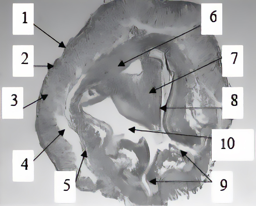 Рис. 1. Поперечный разрез медового зобика и головки промежуточной кишки