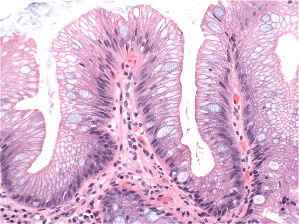 Иллюстрация: springer.com