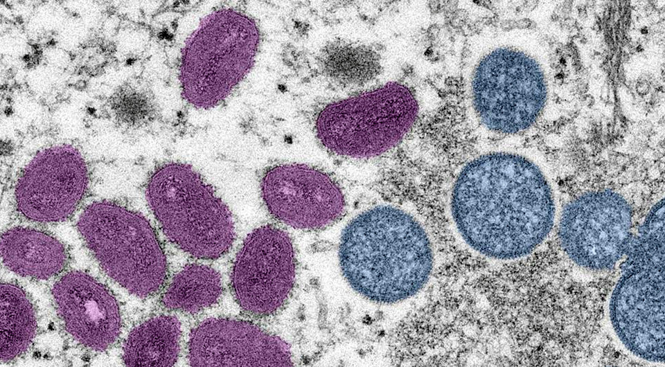   Cynthia S. Goldsmith, Russell Regnery / CDC