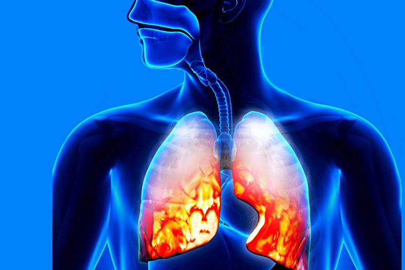 "Ходячая пневмония"! Как защититься?