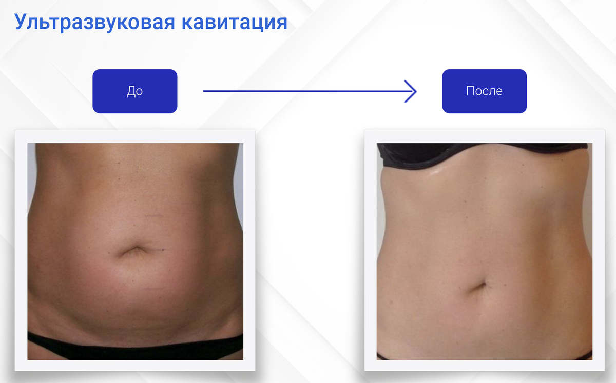 Кавитация