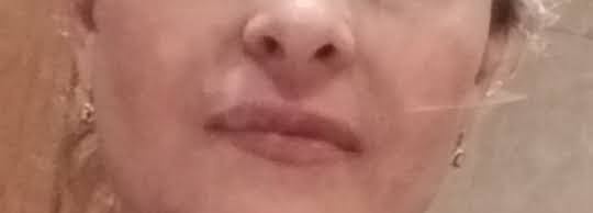 До процедуры