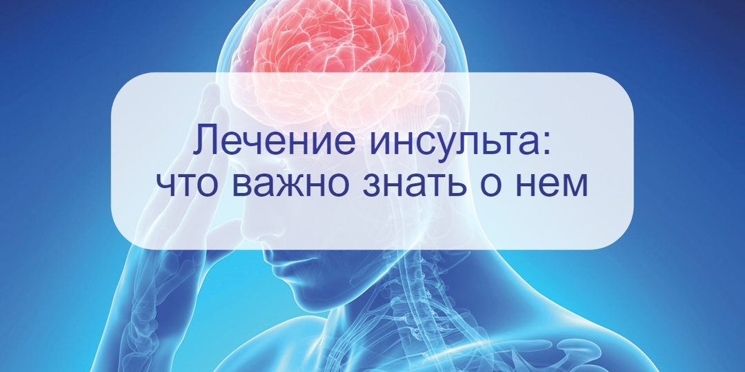 Если случился инсульт: врач рассказала – как проводится лечение и постепенная реабилитация
