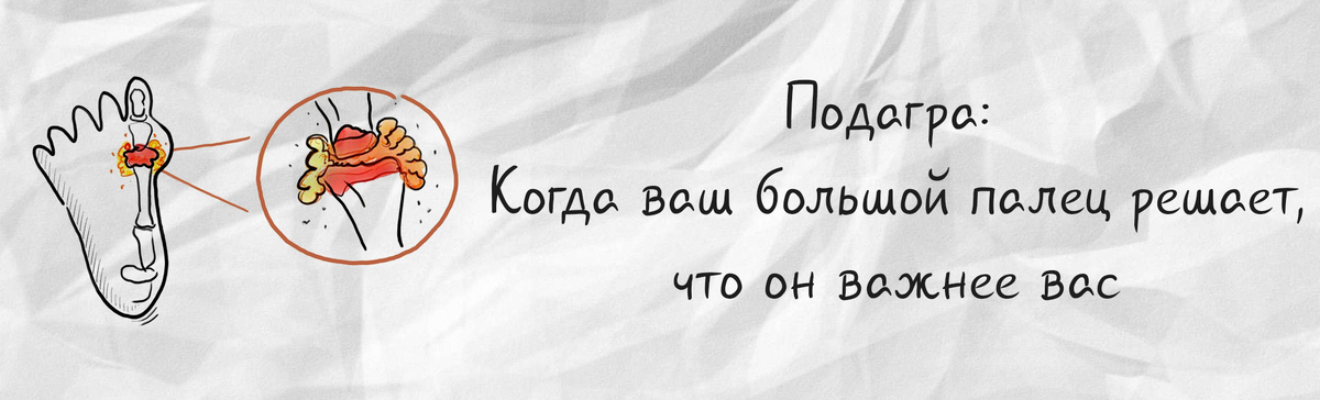 Подагра, от боли к здоровью: полное руководство по контролю мочевой кислоты