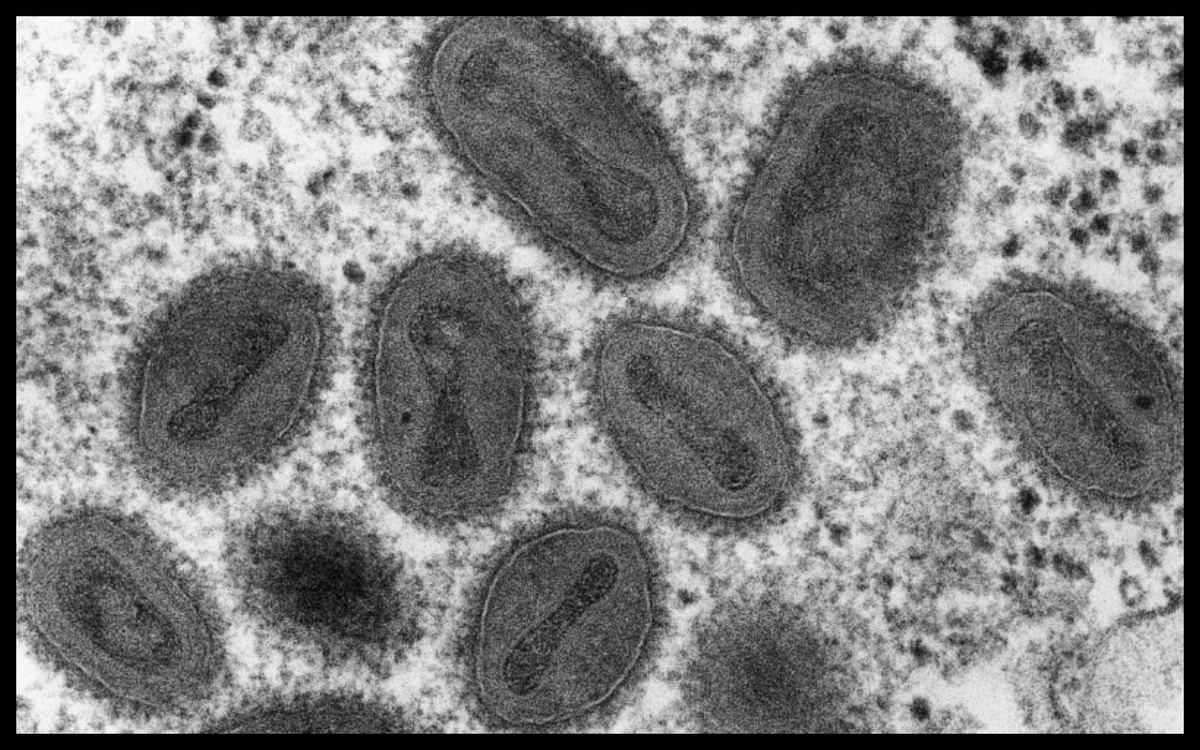 Вирус натуральной оспы