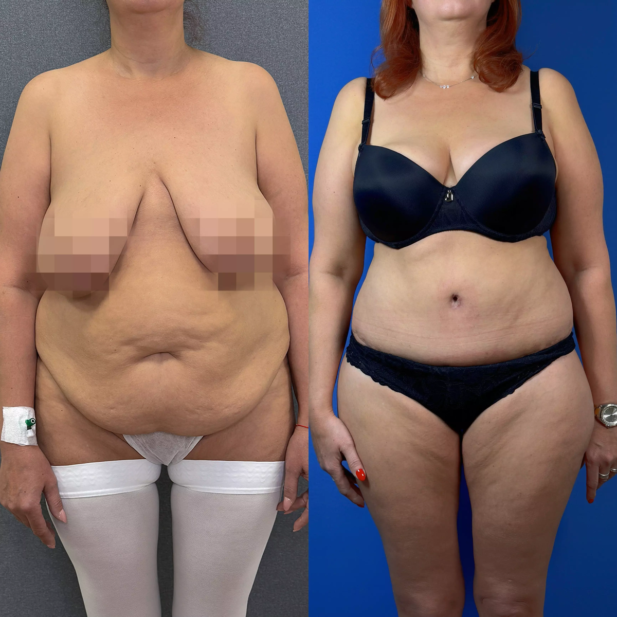 На фото пациентка Данилы Лупина. Имеются противопоказания, необходима консультация специалиста