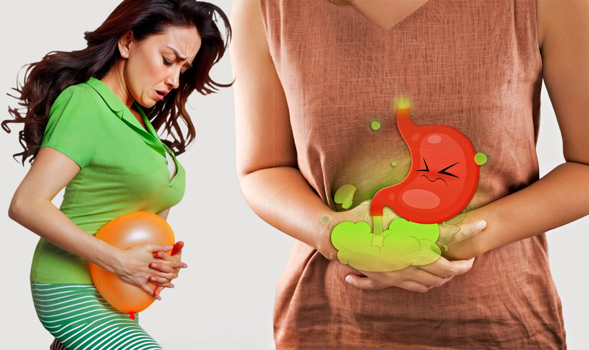 Газовая атака и вздутие живота: как перестать быть ходячим воздушным шариком🎈Метеоризм, от чего пучит и как бороться с деликатной проблемой