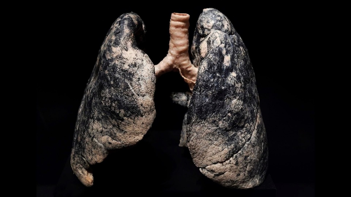 И это не просто страшная картинка, а реальность.