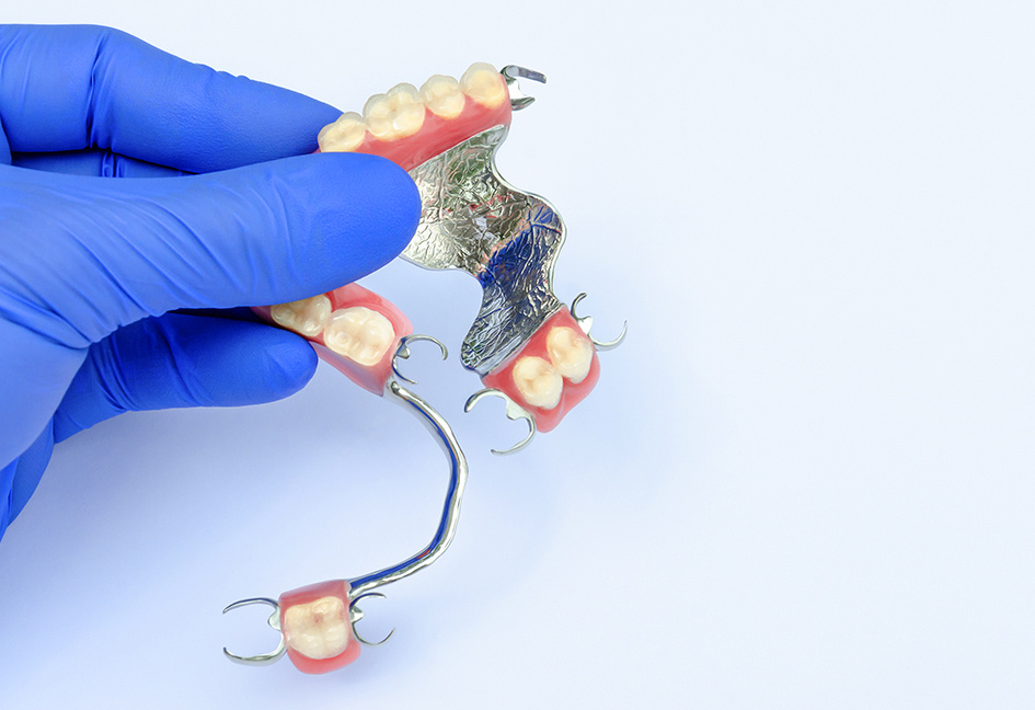 Это совсем старые протезы, еще без коронок, имели кучу недостатков