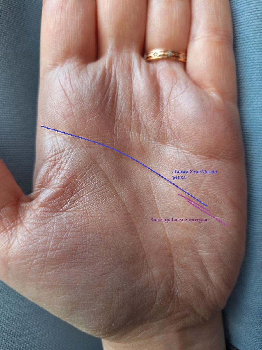 Знак "Проблемы с матерью" на моей руке.