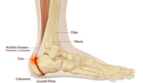 Gациенту может быть рекомендовано либо консервативное, либо оперативное лечение