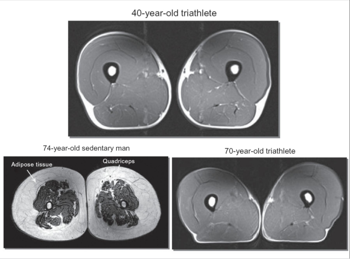 Перевод: На нем изображены мышцы ног 40-летнего триатлониста, 74-летнего мужчины, ведущего малоподвижный образ жизни, и 70-летнего триатлониста.