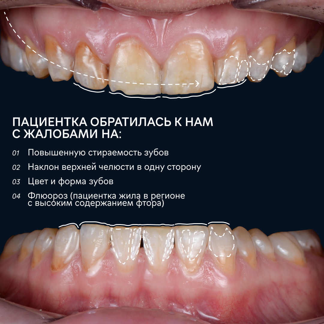 Ситуация до лечения