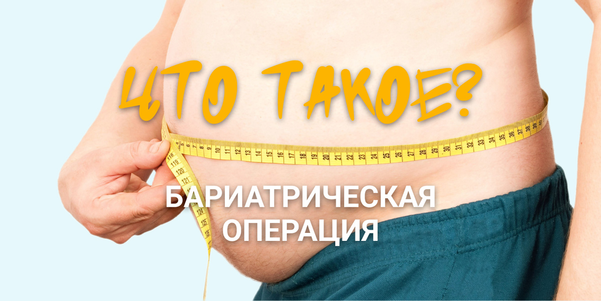 Что такое бариатрическая операция?