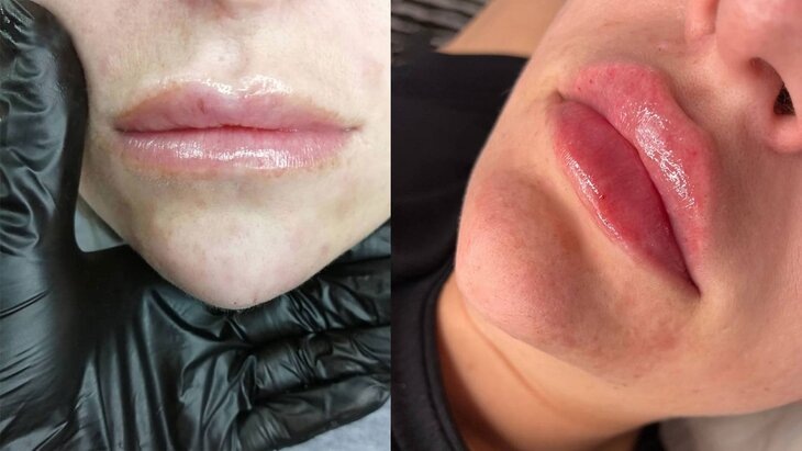 Фото: телеграм-канал SHOT